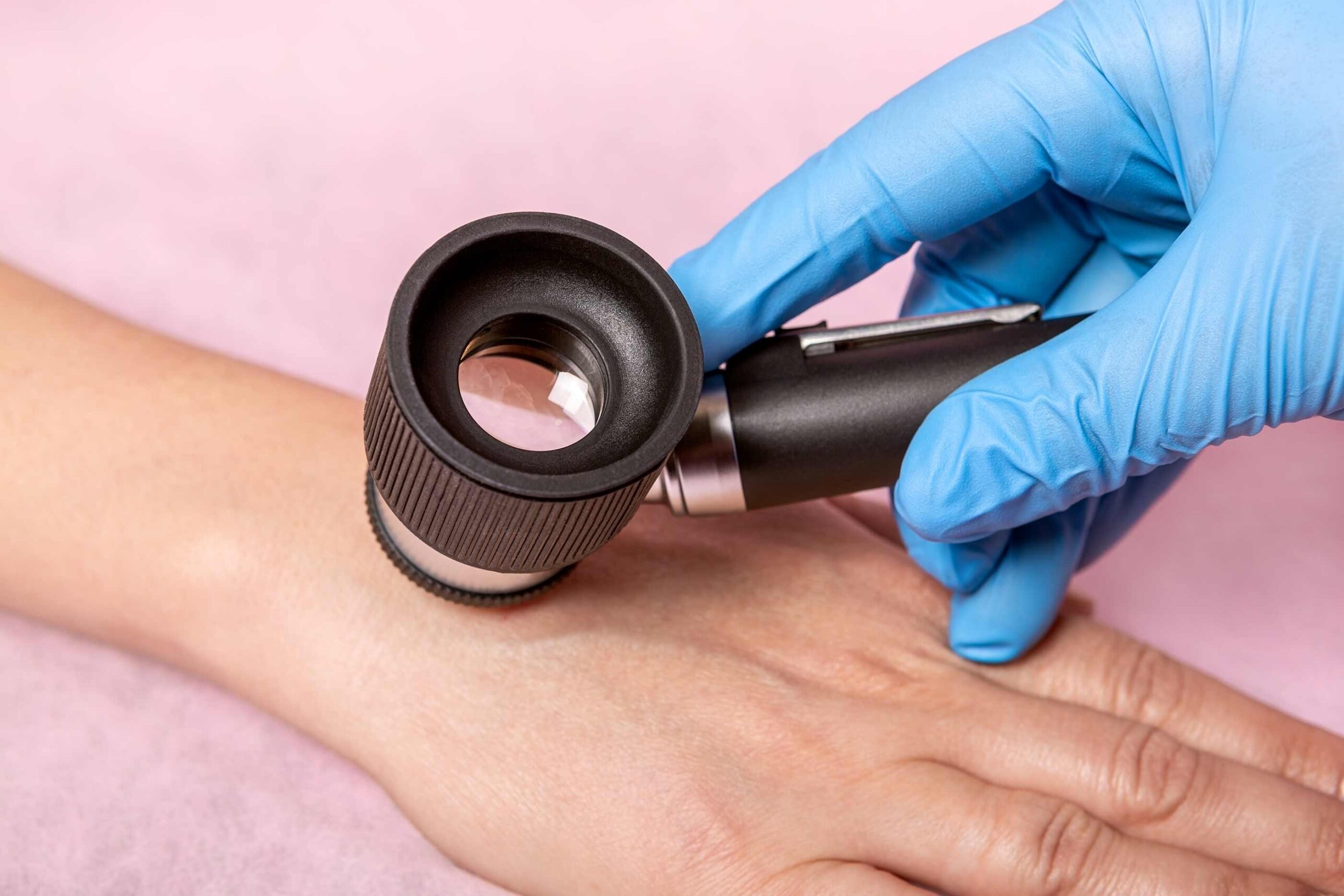 skin doctor looking at someones hand