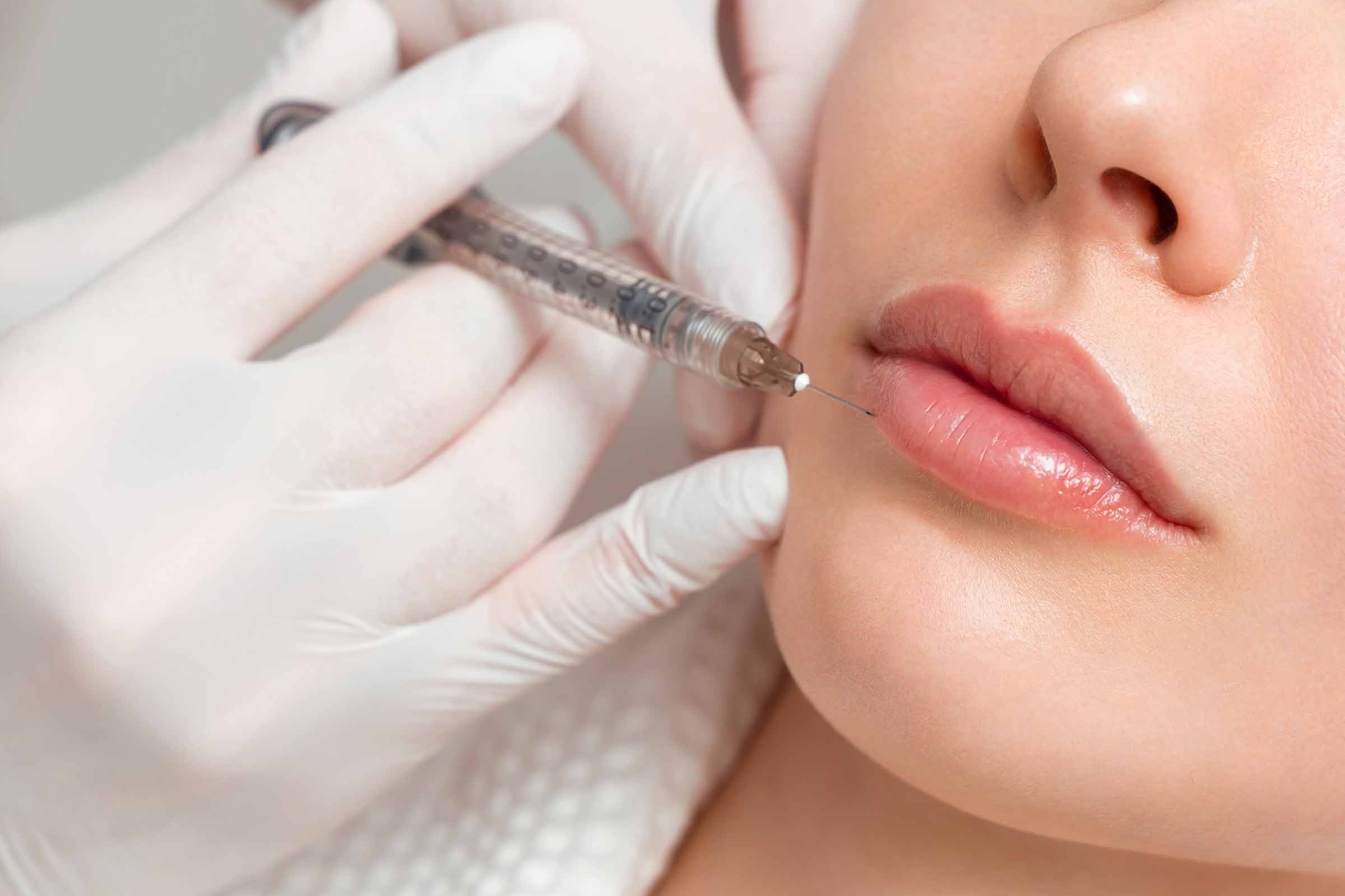 woman receiving lip filler treatment